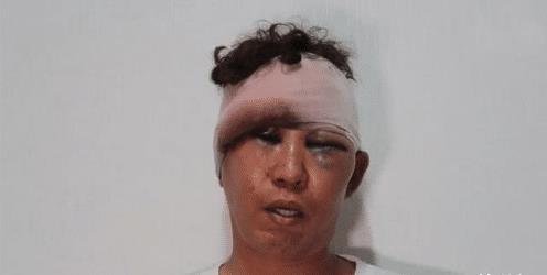 男子对女邻居礼貌性点个头，遭对方男友打到住院：他看我女友