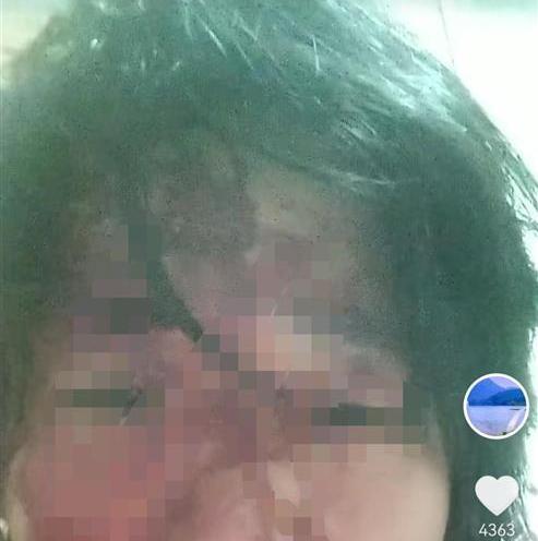 被公公打的头破血流 是家暴还是故意伤害 网友吵翻天