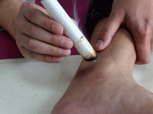 咽炎|阴虚更容易得咽炎,因为阴虚更容易上火,2个方法,咽喉越来越好