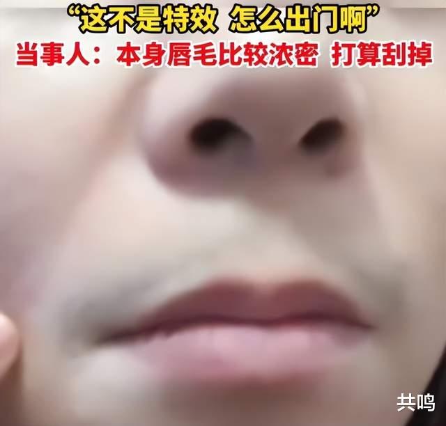 江苏苏州一女子称,感染新冠后真的阳了,唇毛比以前浓