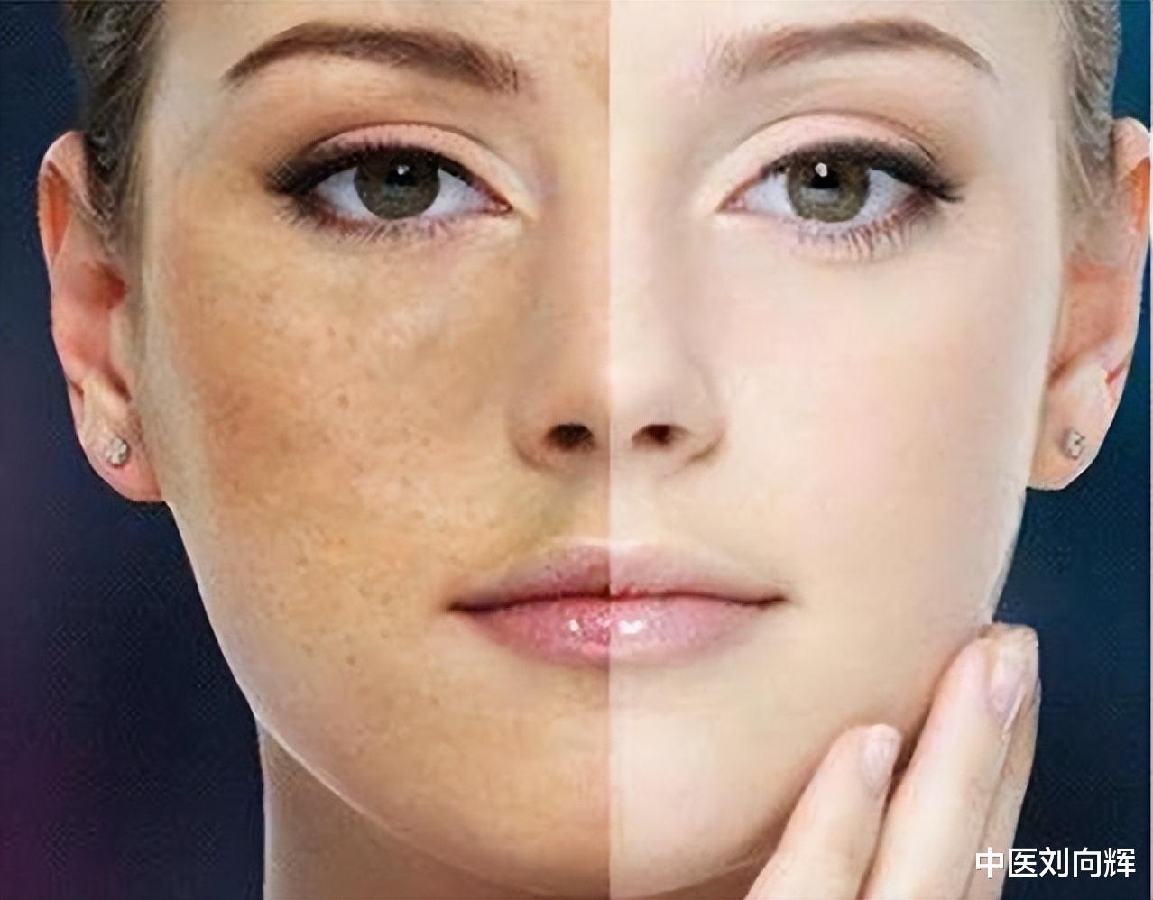 |血虚脸色暗 血瘀脸长斑,一个奇方佛手散,养血化瘀,祛淡斑 养气色