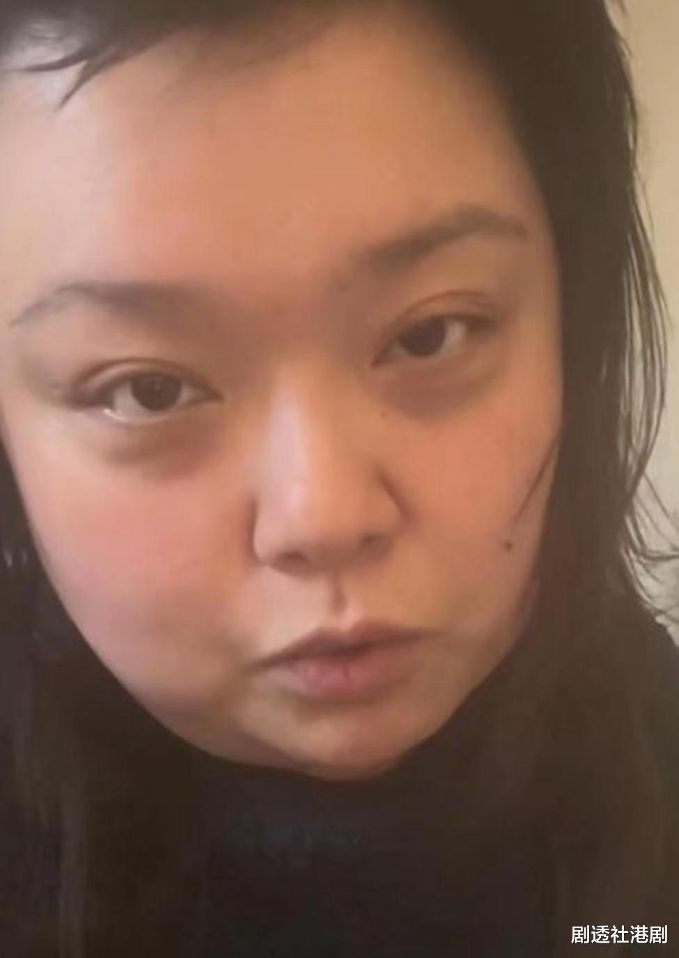 陈嘉佳|憔悴！TVB前搞笑女星晒病恹恹近况，曝三天没洗头没洗澡连狗都嫌臭