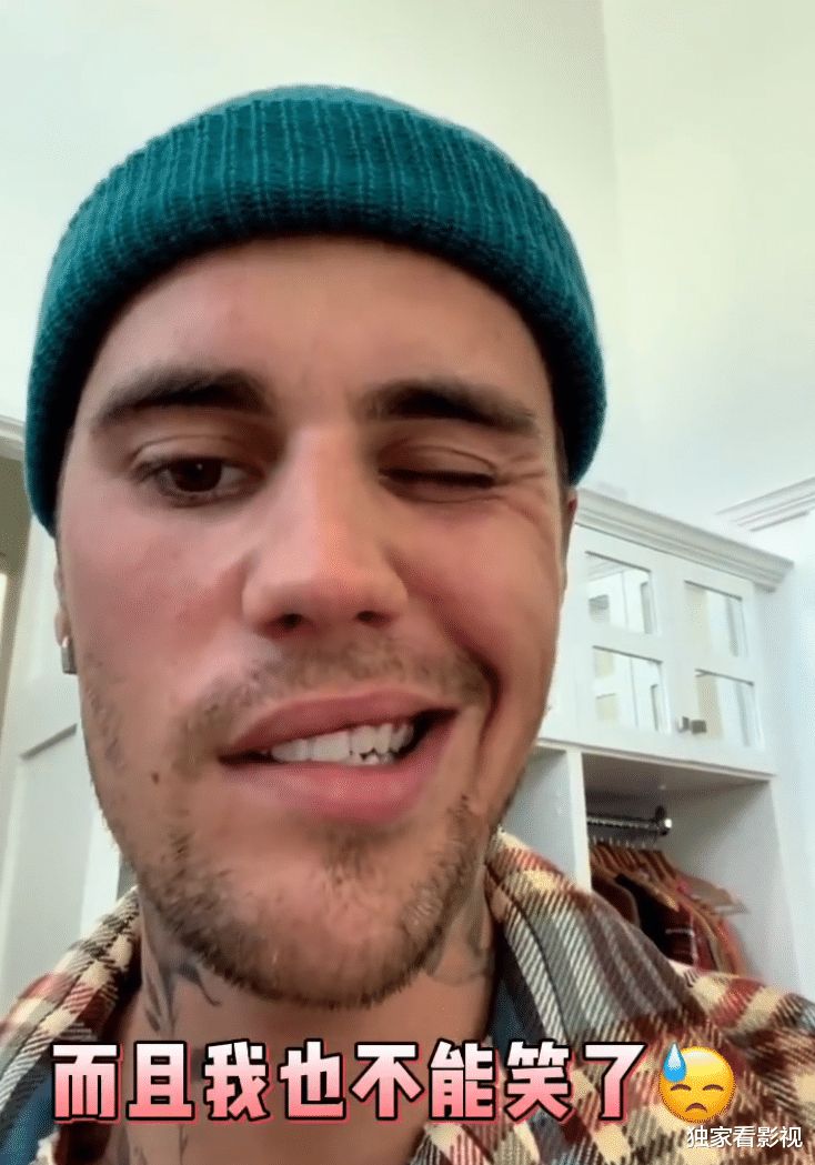 贾斯汀·比伯|28岁比伯面瘫，半边脸不能眨眼不能笑，被迫中止演唱会损失数千万