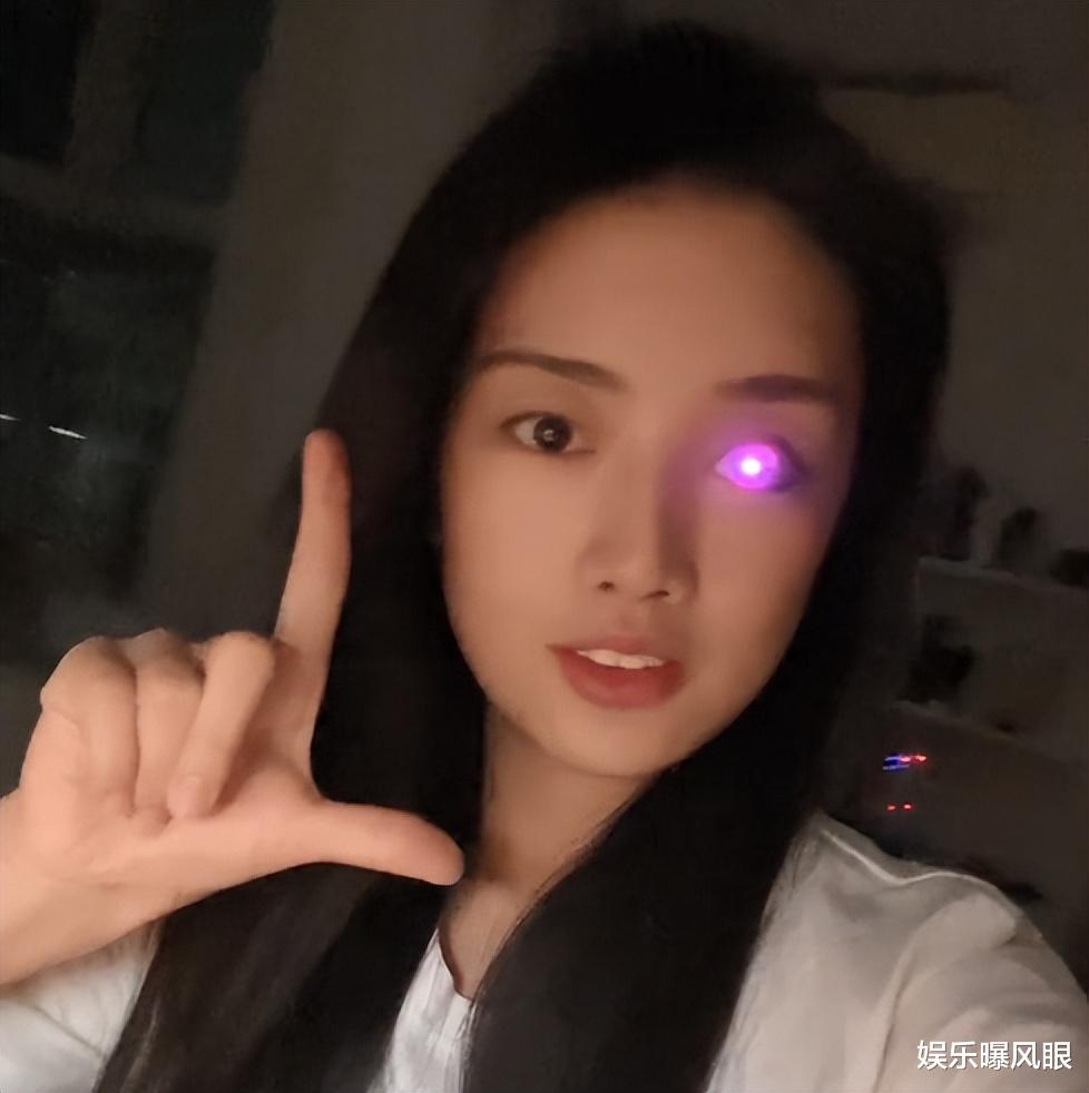 “眼睛发光”女孩昕瞳走红!18岁因车祸失去右眼,下楼梯经常踩空