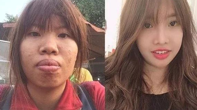 丑姑娘花9万元整容成功嫁富二代，生下孩子后被抛弃，现状如何？