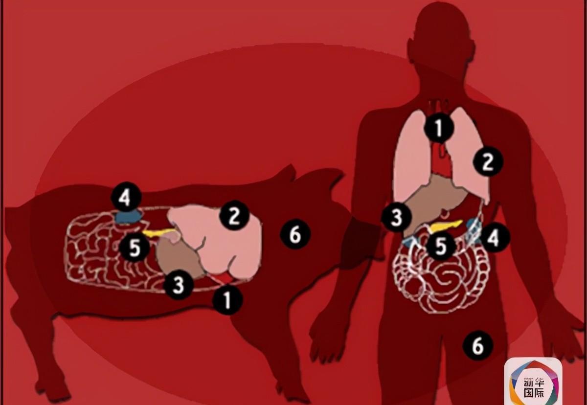 我们的腰子有救了？猪肾移植人体后正常工作，人类将自然老死吗