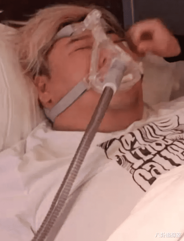 短发 泡泡龙2.0？曝胖猴仔减肥出意外，被下3次病危，妻子却见钱眼开