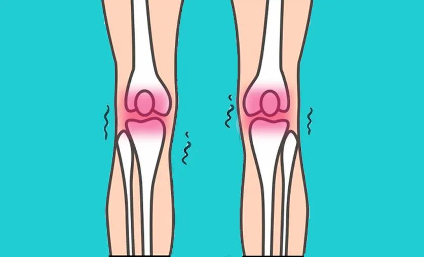 |这3个坏习惯，正在“毁掉”你的膝盖！