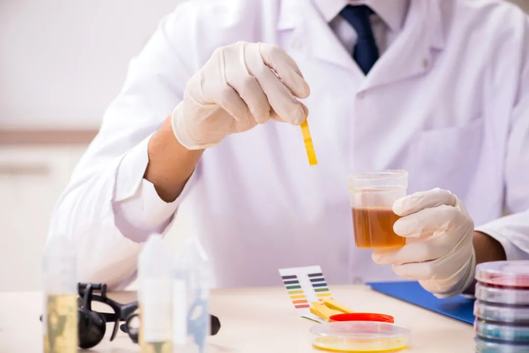 尿常规|尿常规报告透露的4个信号,这项不达标的多半肾不好