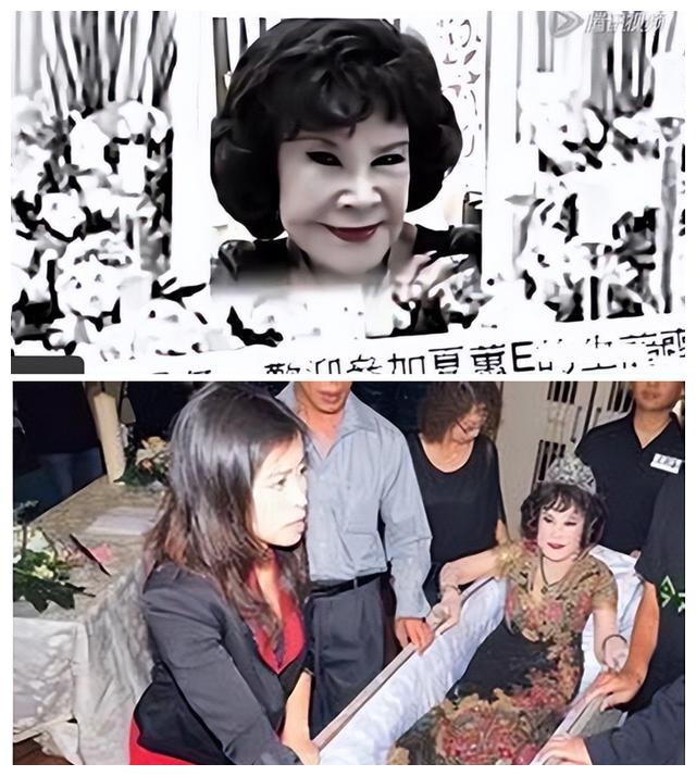 明星|明星整脸有多拼？“一刀切”说做就做，有女星因后遗症影响一生