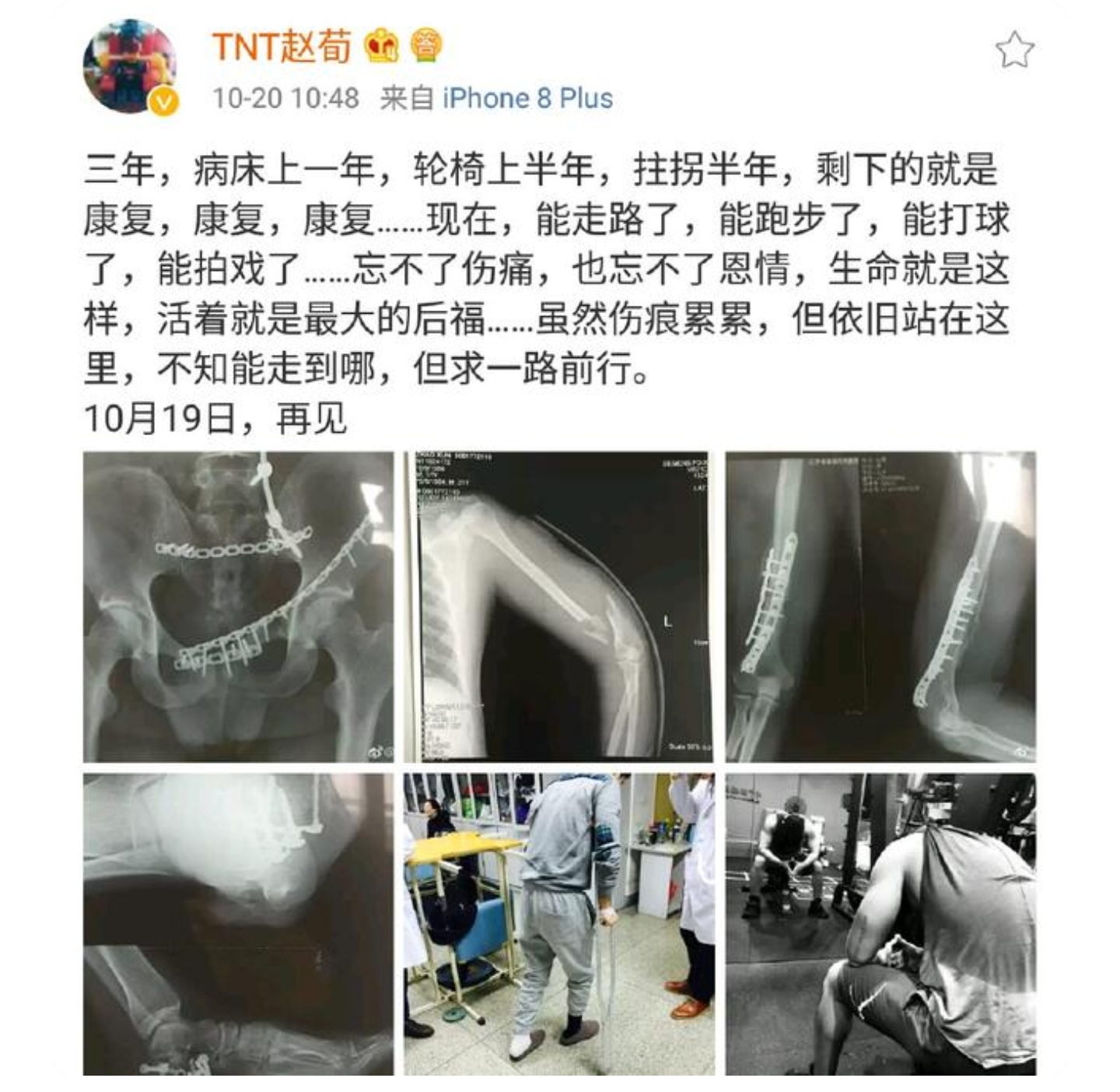 赵荀|7年前坠楼瘫痪，却坐轮椅坚持拍戏: 比成龙还玩命的他如今终于走红！