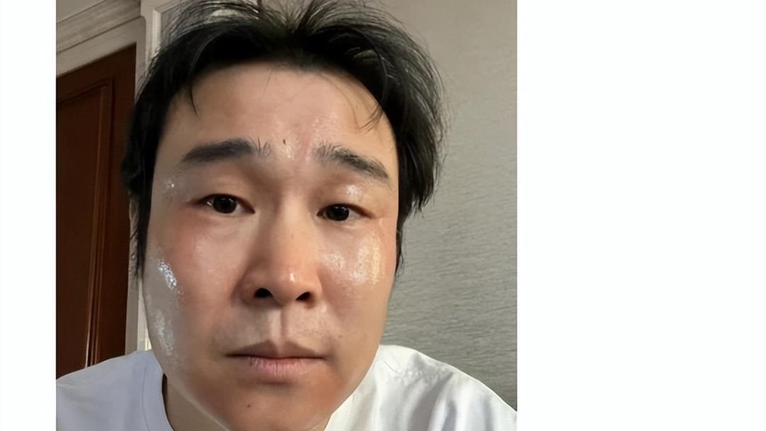 刘诗诗|明星染新冠，脸疼、屁多、还有变漂亮的？