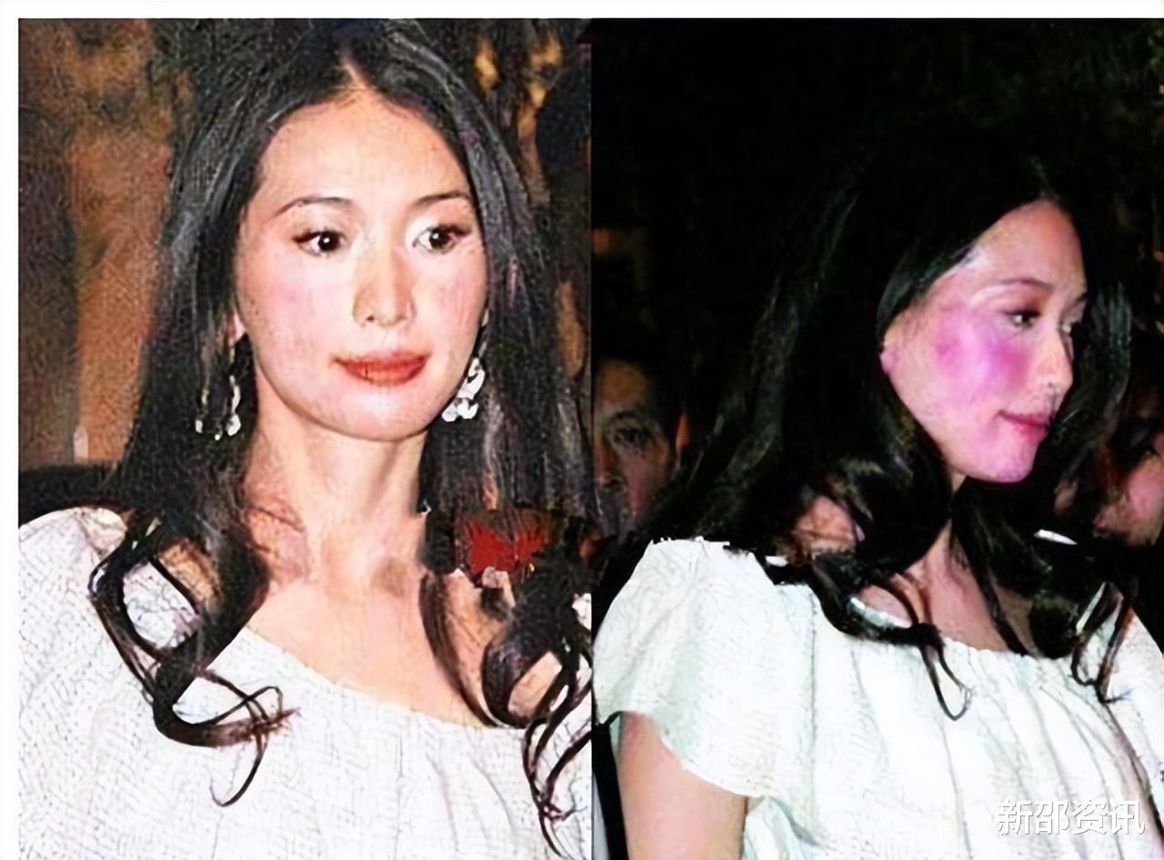 明星|“奇葩病”缠身的8大明星：有人吃猪肉会醉，有人口水过敏