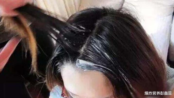 疾病 经常染发会有哪些危害？多久染一次头发最好？别超过这个范围