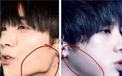 华晨宇|动脸动到“面目全非”的4位明星，华晨宇陈小纭上榜