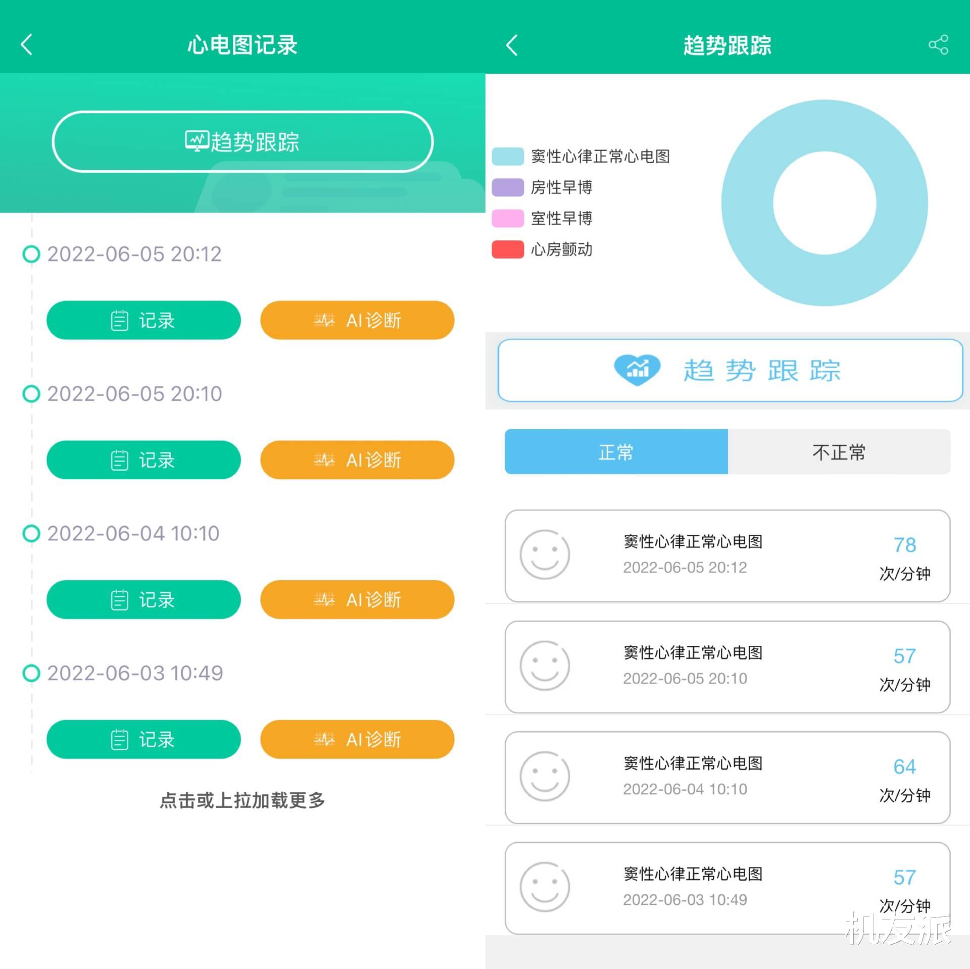 dido|性价比首选!dido E10血压心电智能手表上手体验