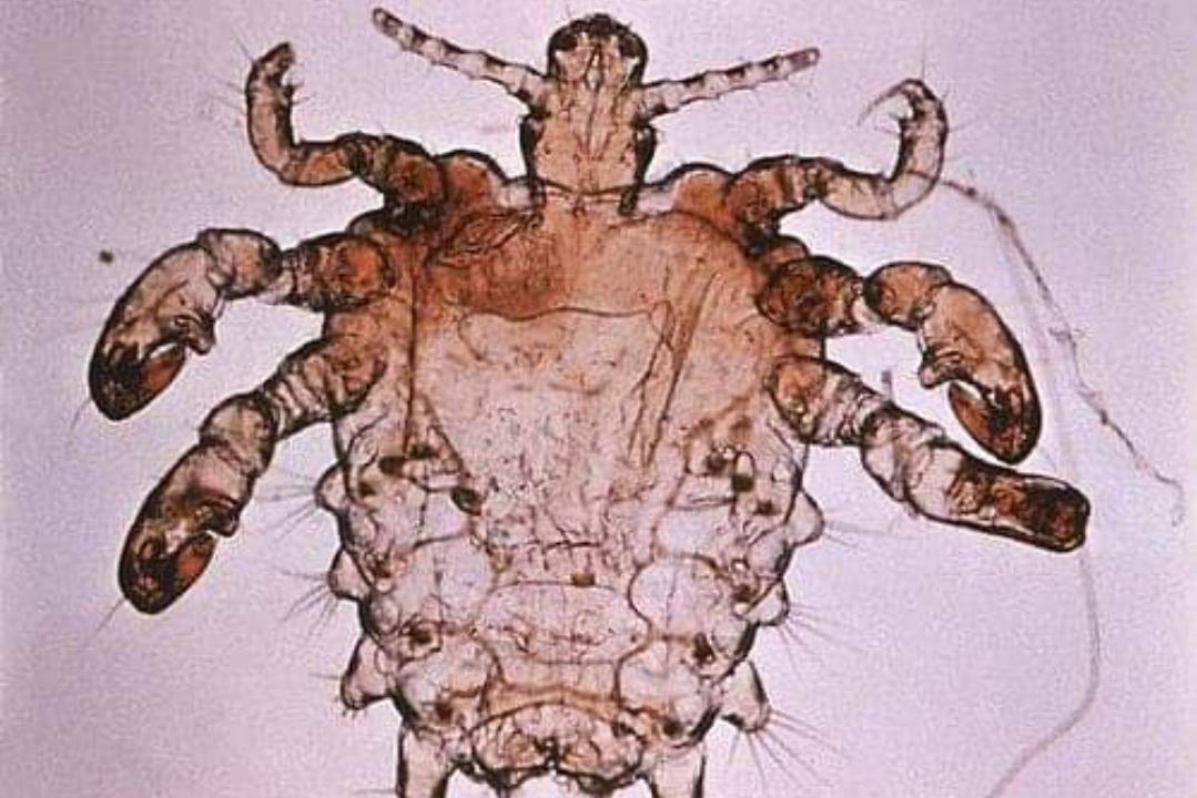 同样是虱子,为什么头虱、体虱、阴虱不能离开自己的地盘?