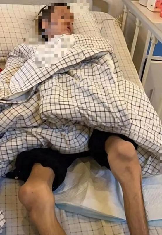 19岁男孩游泳后住ICU,花60多万却仍全身抽搐,和游泳馆的水有关吗?