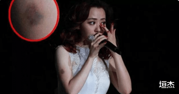 赵本山|球球官宣喜讯，赵本山保持沉默，不被父母祝福的婚姻，还是别嫁了