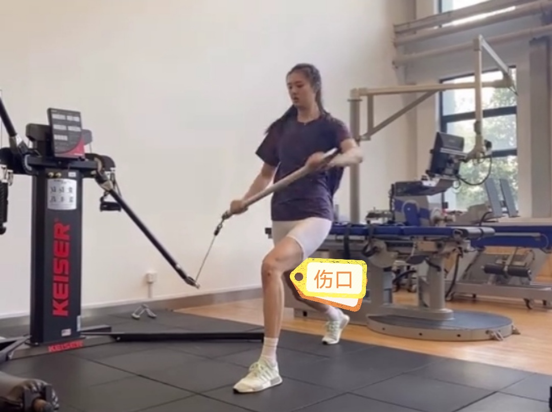 张常宁|张常宁恢复神速，已进行力量训练，腿上伤口清晰可见