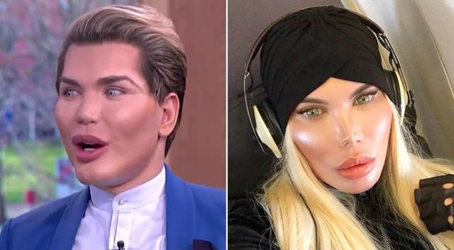 整容|巴西少年想整容42次变“芭比男友”,没火起来改行跑去搬砖了