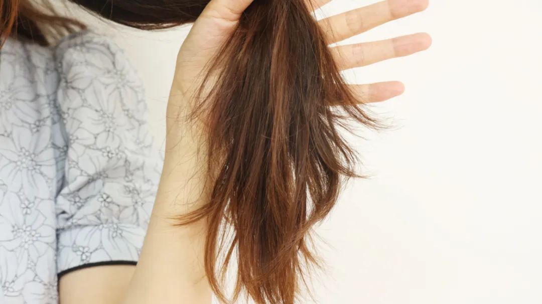 疾病|白发突然增多，是缺少维生素的表现？足量补充，白头发会减少吗？