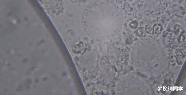 情侣|将人的口水放大4000倍，看完一阵恶寒，为何情侣接吻时不觉得恶心