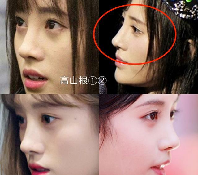 张雨绮|隆过鼻子的十位明星,张雨绮鼻梁变宽,毛晓彤很自然