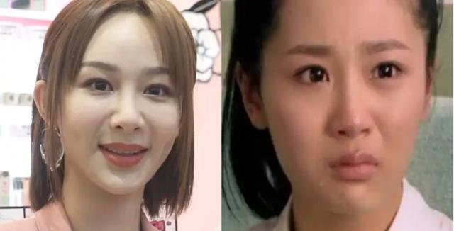 张雨绮|隆过鼻子的十位明星,张雨绮鼻梁变宽,毛晓彤很自然