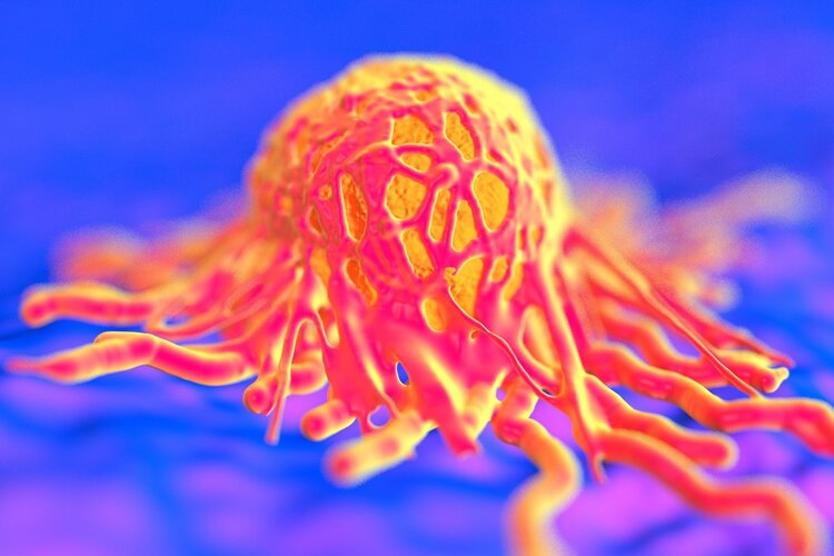 医生|体内有疾，眼睛有预兆！眼睛出现6种异样，或是癌症或疾病的预警