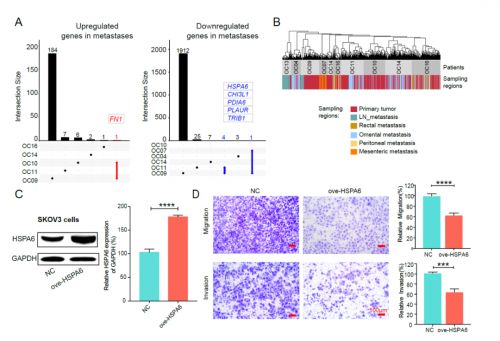 Cancer Res:揭示高级别浆液性卵巢癌的分子调控机制