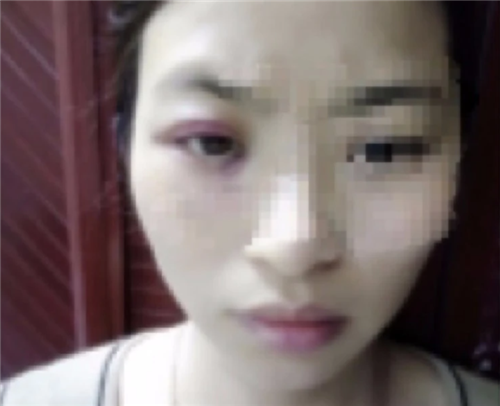 广东家暴致死案:女老师婚后被家暴5年,提离婚被丈夫活活打死!