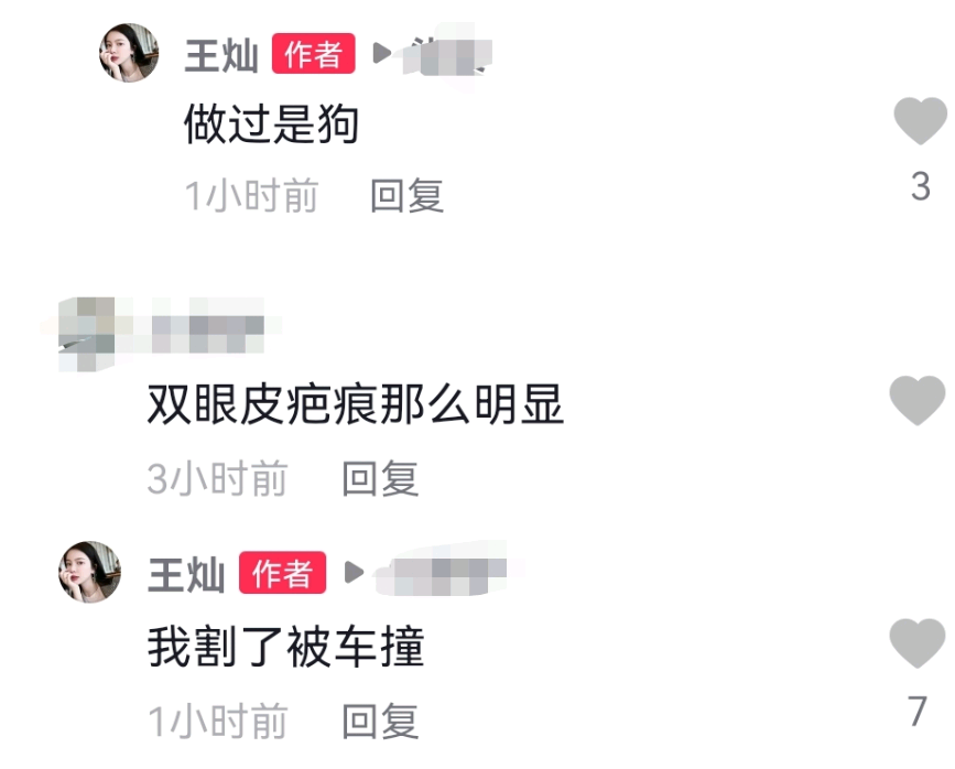 王灿|杜淳老婆大方晒素颜照，却被质疑整鼻子下巴，王灿霸气回怼恶评