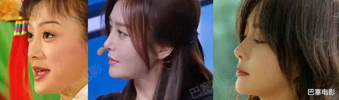 牛莉|好好的美女非去弄鼻子,林心如鼻子像被夹住,牛莉一个鼻孔两个大