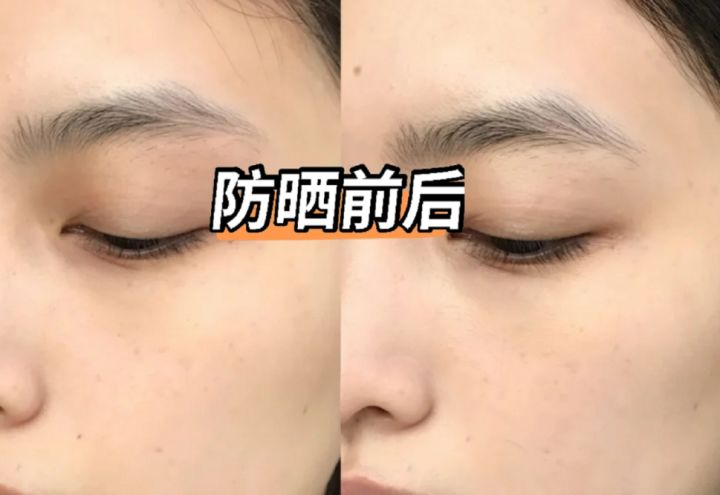 护肤品 孕期如何拯救“烂脸”？4款平价好用的“老牌护肤品”，值得入手