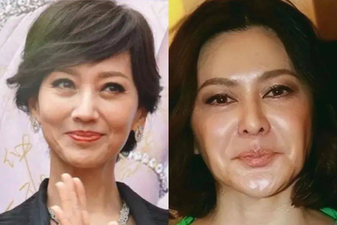 关之琳|年轻时惊艳四座，老了成“妖魔鬼怪”，这9位老牌女神太可惜了