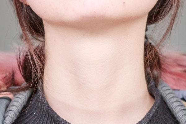 甲亢|得了甲亢的人,身体可能有6个异常变化,如果一个也没有,恭喜你