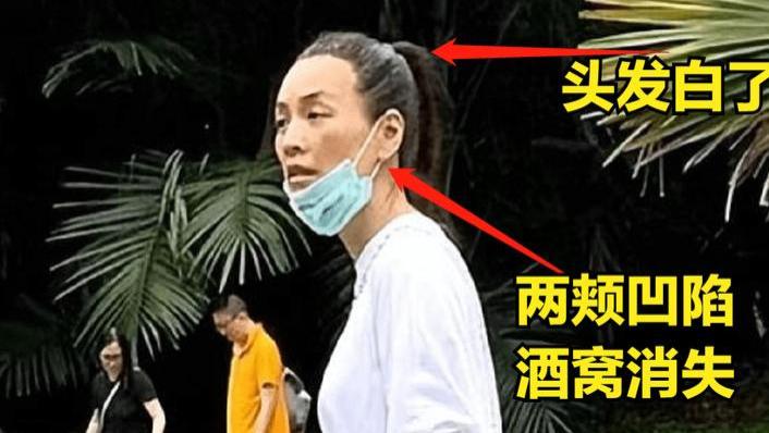 张庭|爆张庭现身新加坡，网友发现其面容苍白，头发出现花白的迹象