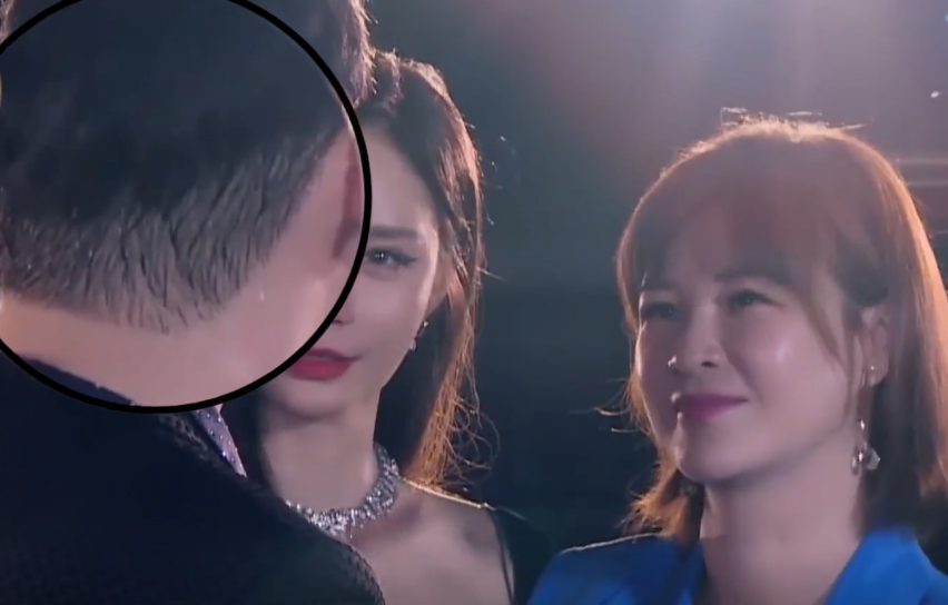 沙溢|看似帅气,实则脱发严重!沙溢、彭于晏、白敬亭......心酸又好笑