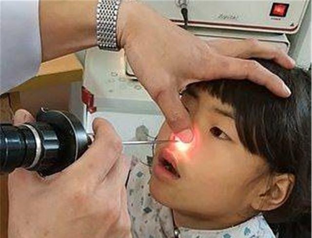 蚊子|如果蚊虫不小心飞进身体里,将会发生什么?最后结果超出你的想象