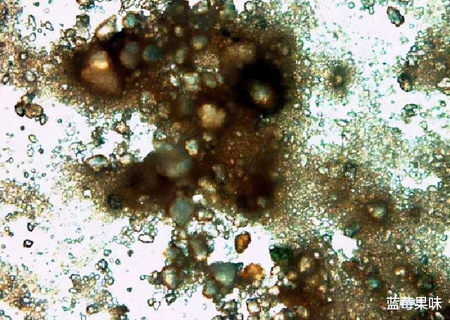 汗疱疹|洗澡搓下来的黑泥到底是什么?显微镜放大100倍,看完一阵恶寒
