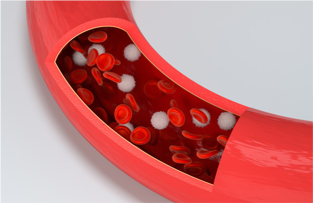 中医养生|不想给血管“添堵”,要尽早清除三种血管“垃圾”,望你早做了解