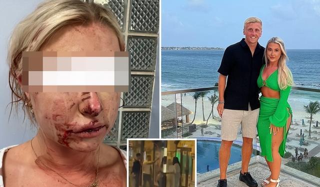 太可恶!英格兰球员女友深夜在街头无端被打,施暴者逃跑仍未归案