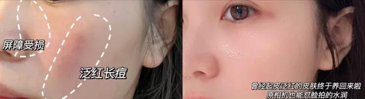 护肤品 热门水乳真实测评｜避免智商税高性价比保湿美白修复水乳套装推荐