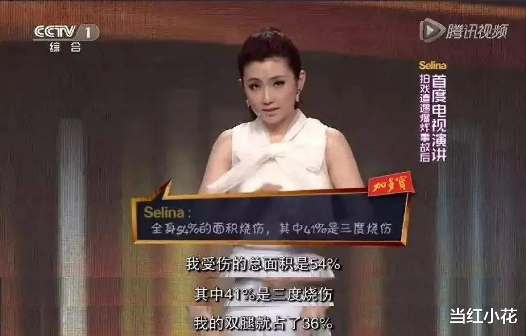 Selina|惨遭毁容、失声、被离婚后，selina首谈姐弟恋：女人四十，才是人生起航