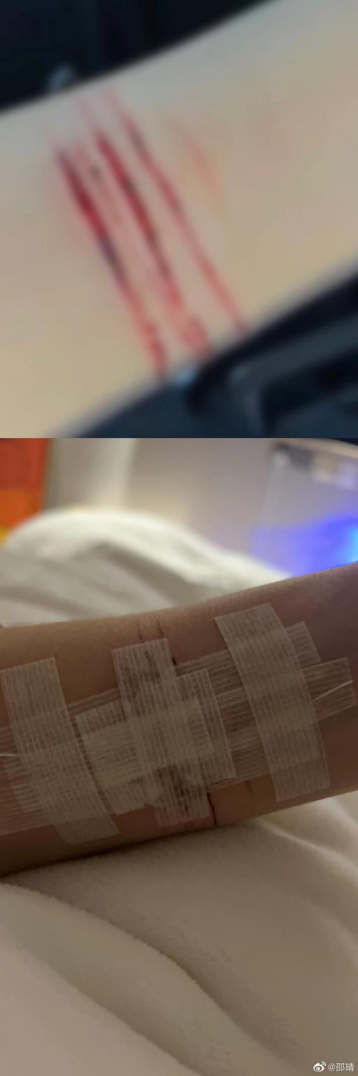 邵晴|邵晴成背锅侠？发长文否认插足张嘉倪婚姻，晒抑郁症报告网友不买账