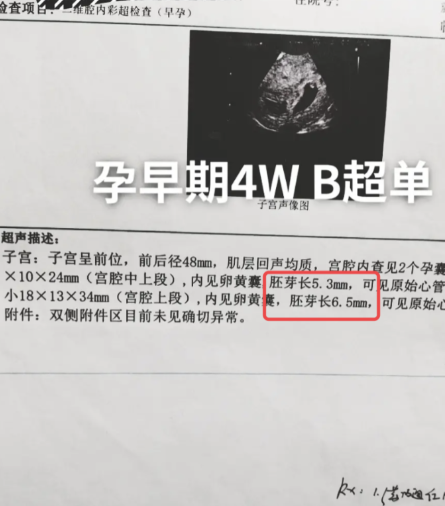 陈萌|大衣哥儿媳人设“翻车”？刚订婚就带货，晒豪车豪宅骨子里喜欢炫富