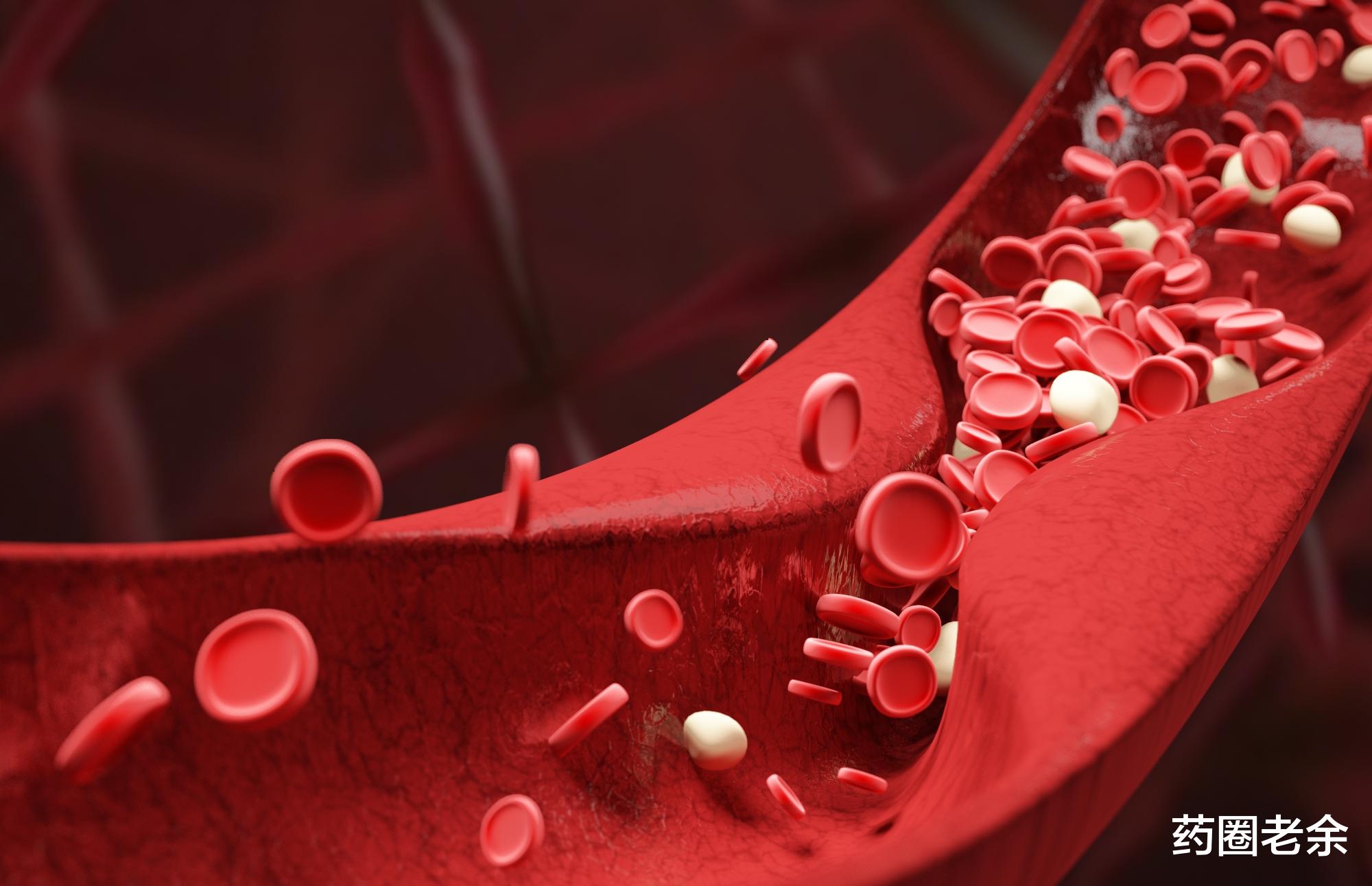 肠胃|【心脑血管】这8类人容易血管堵塞,看看有没你?