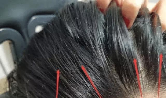 香菜 被拉入“黑名单”的洗发水，学生党却偏爱，难怪头发“大把掉”