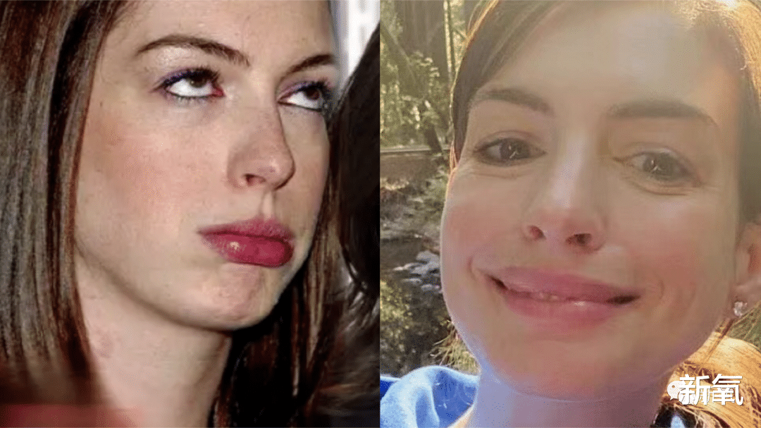 祛斑|安妮海瑟薇是怎么回春的？